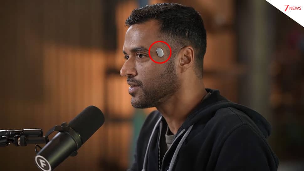 Deepinder Goyal’s Temple Wearable: Did You Know About Small Device Seen On Zomato CEO’s Head? Check How It Works And His Net Worth | Technology News
