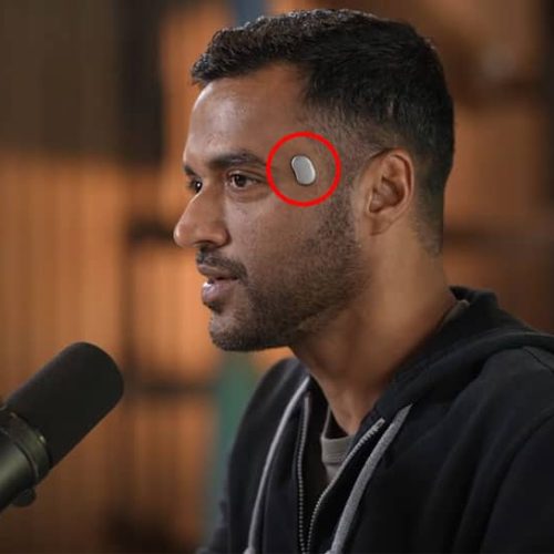 Deepinder Goyal’s Temple Wearable: Did You Know About Small Device Seen On Zomato CEO’s Head? Check How It Works And His Net Worth | Technology News